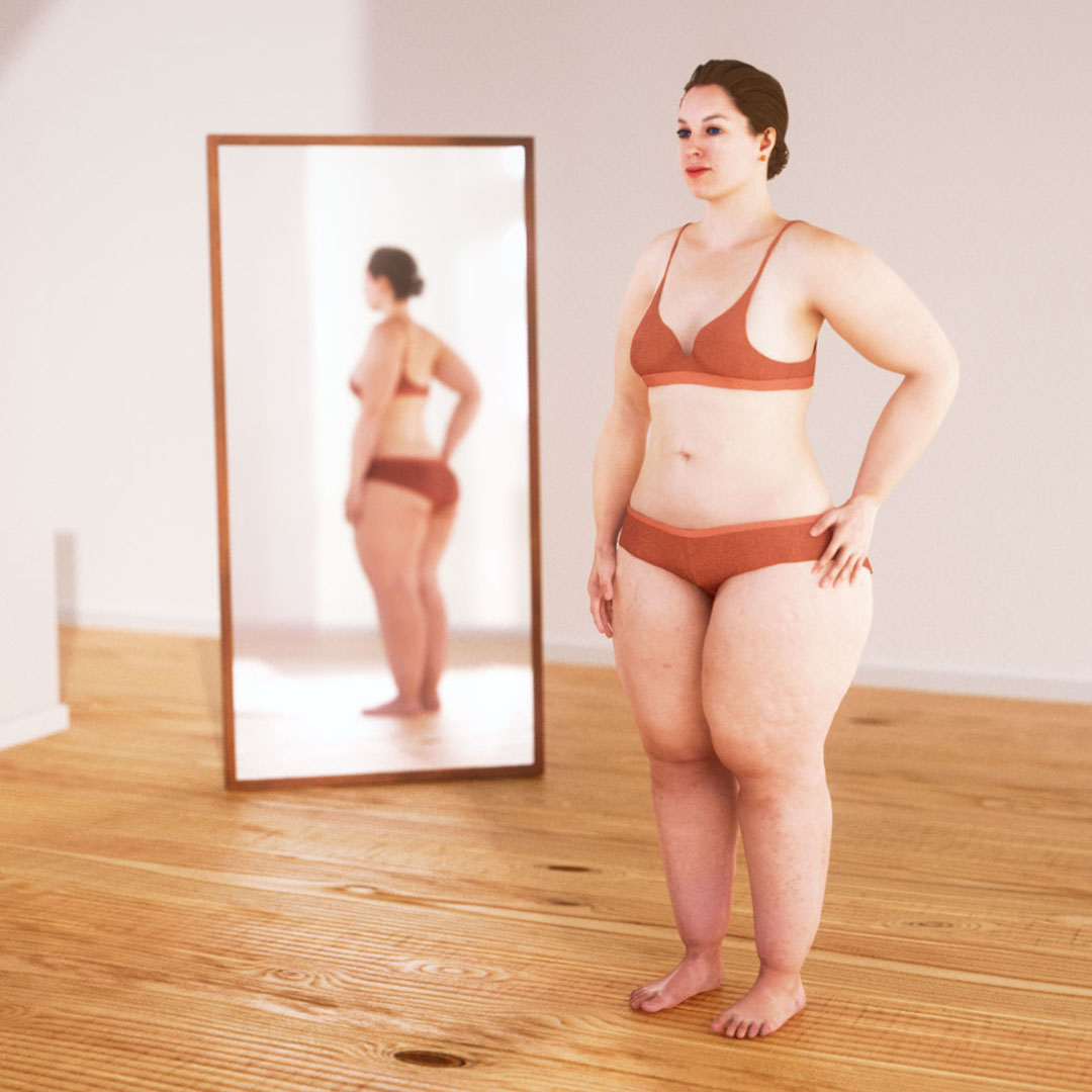 An image of a lipedema patient showing the physical changes, presented in a bright and positive tone.
